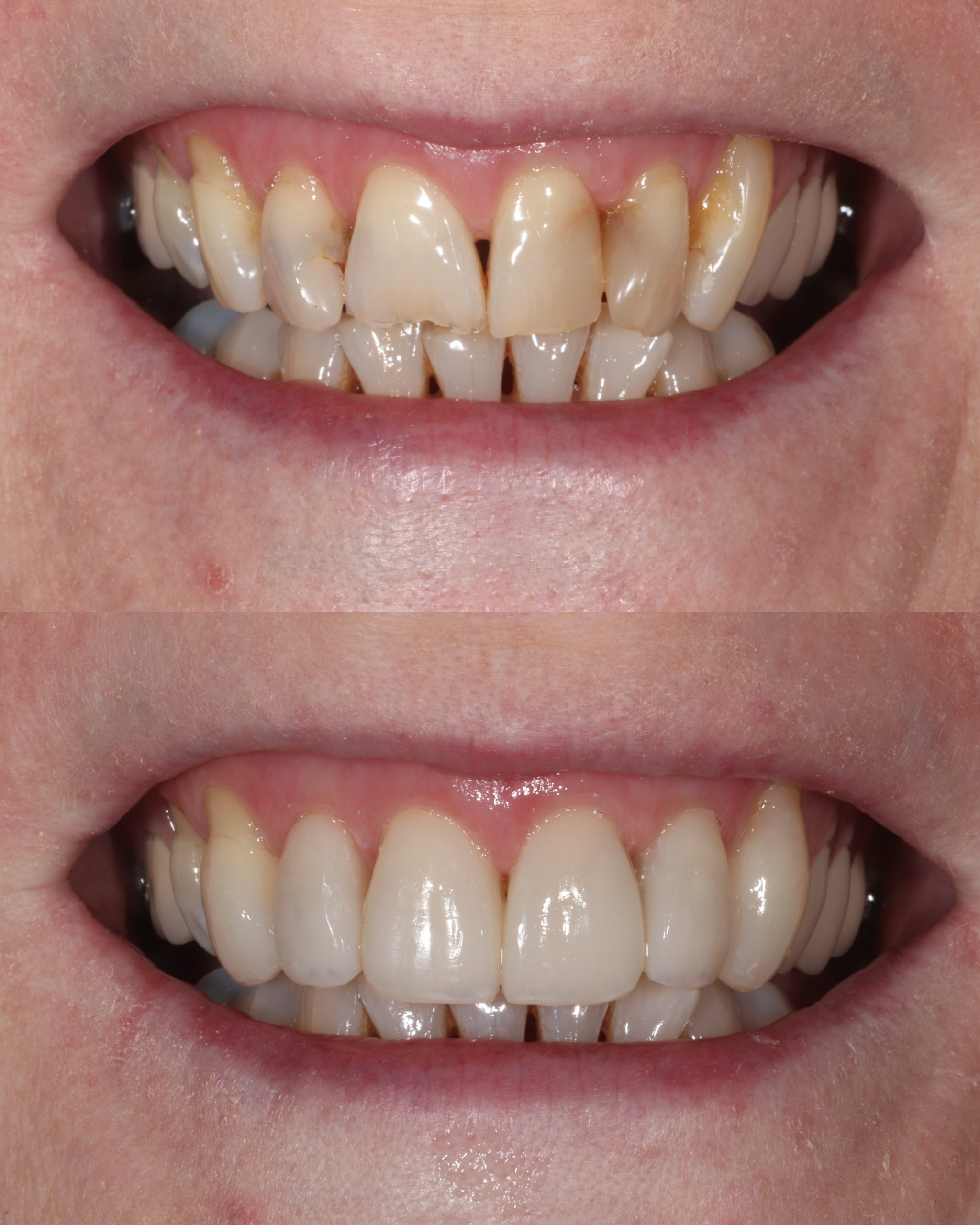2026-06-23 - PS_Smile - collage - eddtr